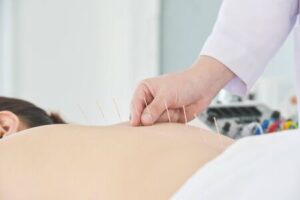 144212876-primer-plano-de-las-manos-haciendo-acupuntura-con-la-espalda-del-paciente-concepto-de-medicina