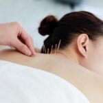 mano-medico-que-realiza-terapia-acupuntura-mujer-asiatica-sometida-tratamiento-acupuntura-linea-agujas-finas-insertadas-piel-su-cuerpo-hospital-clinico_1286-3567